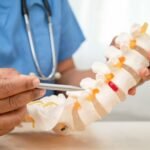 Understanding Spinal Stenosis Diagnosis and Treatment Options