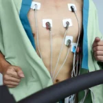 When Should You Get a Cardiologist-Recommended Stress Test?