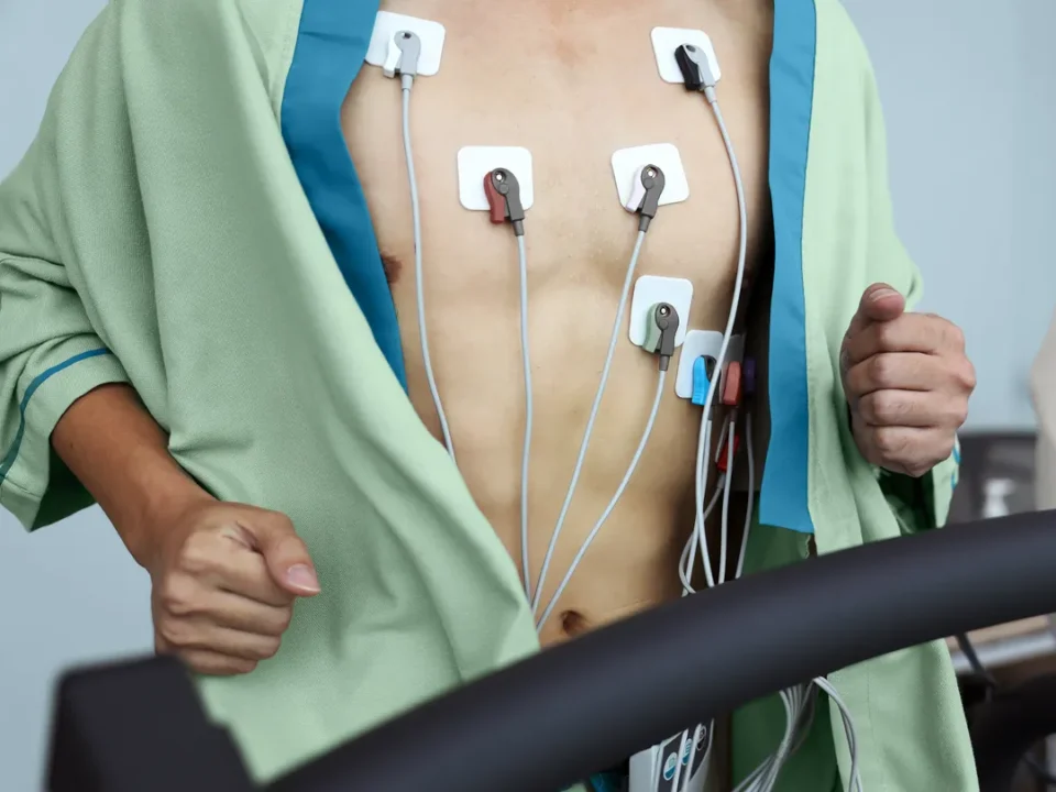 When Should You Get a Cardiologist-Recommended Stress Test?