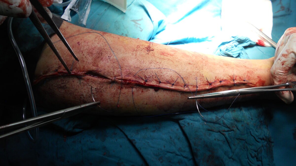 The Benefits of Early Detection in Orthopedic Surgery