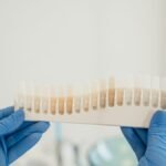 The Benefits of Porcelain Veneers for Teeth Alignment Issues