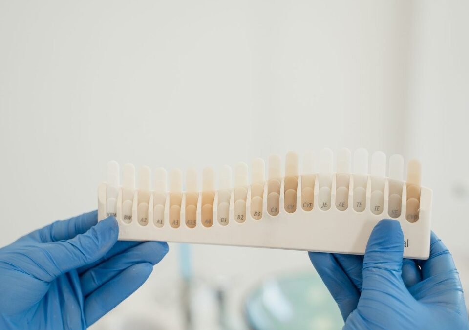 The Benefits of Porcelain Veneers for Teeth Alignment Issues