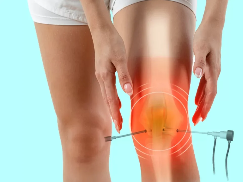 The Role of an Arthroscopy in Joint Diagnostics