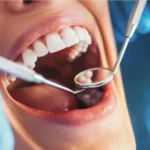 Types of Services a Dentist Offers