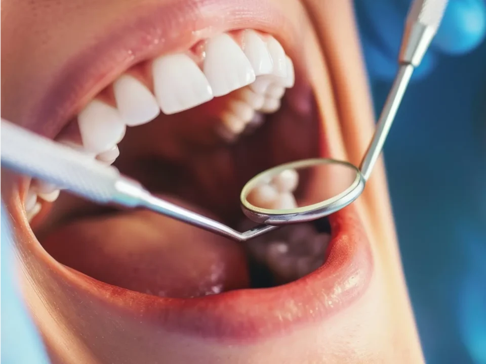 Types of Services a Dentist Offers
