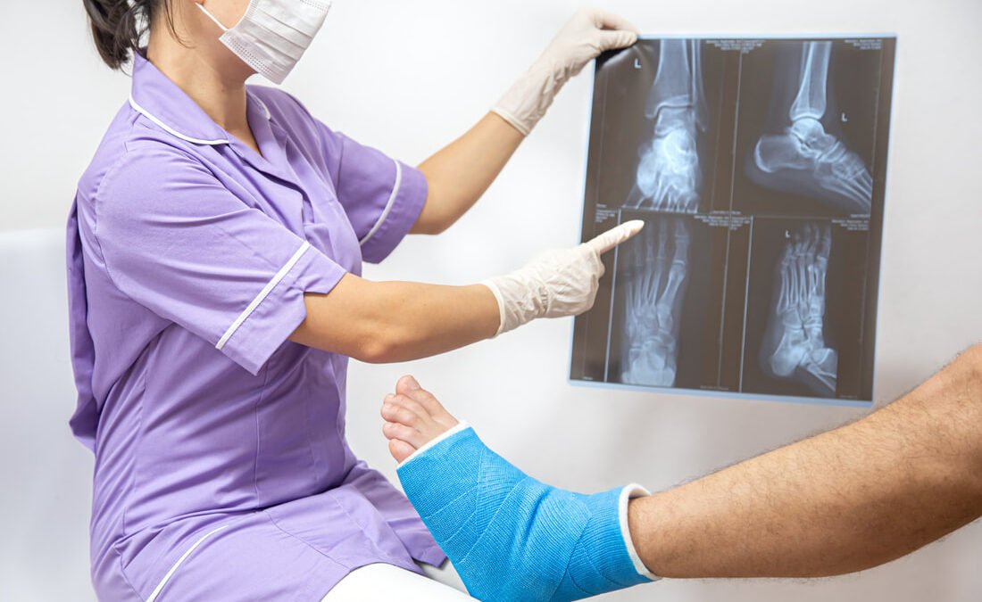 Understanding the Recovery Process of Orthopedic Surgeries