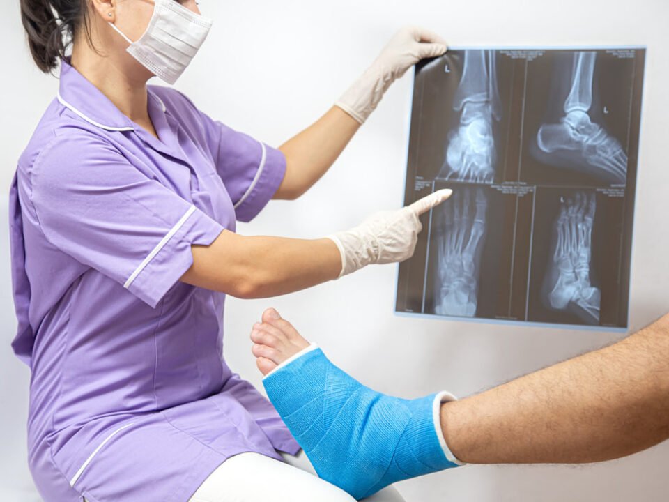 Understanding the Recovery Process of Orthopedic Surgeries